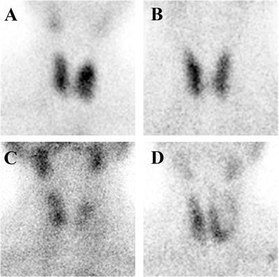 Diagnosis of thyroid disease using deep convolutional neural network models applied to thyroid scintigraphy images: a multicenter study